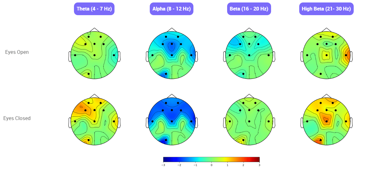 Myndlift qEEG for Sarah qEEg Chart